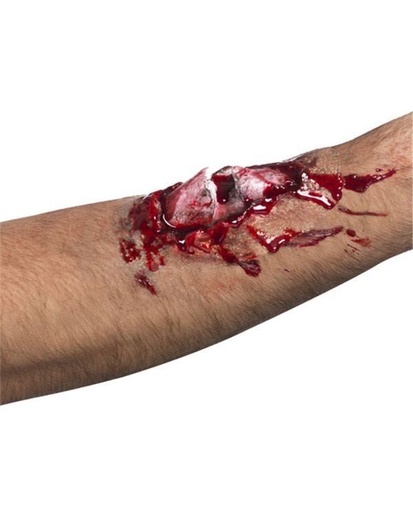 Broken Bone Wound Kit