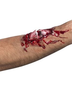 Broken Bone Wound Kit
